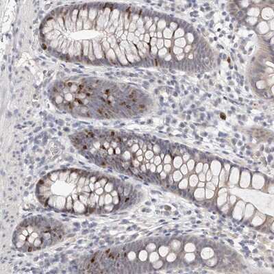 Immunohistochemistry-Paraffin: CCDC190 Antibody [NBP1-82673]