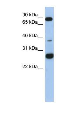 Western Blot: CCDC190 Antibody [NBP1-70448]