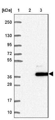 Western Blot: CCDC190 Antibody [NBP1-82674]