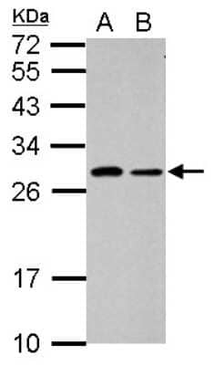 Western Blot: SPATA46 Antibody [NBP2-15640]