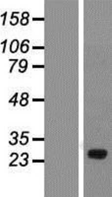 Western Blot: SPATA46 Overexpression Lysate [NBP2-04840]