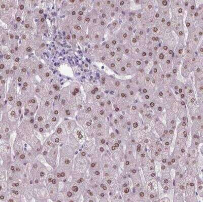 Immunohistochemistry-Paraffin: C1orf112 Antibody [NBP1-83836]