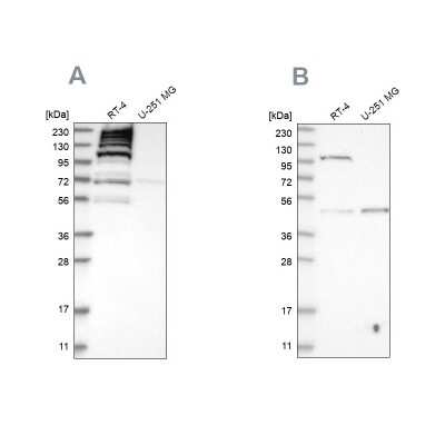 Western Blot: C1orf112 Antibody [NBP1-83835]