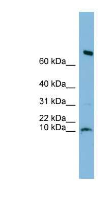 Western Blot: C1orf122 Antibody [NBP1-70452]