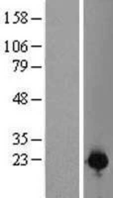 Western Blot: CZIB Overexpression Lysate [NBL1-08294]