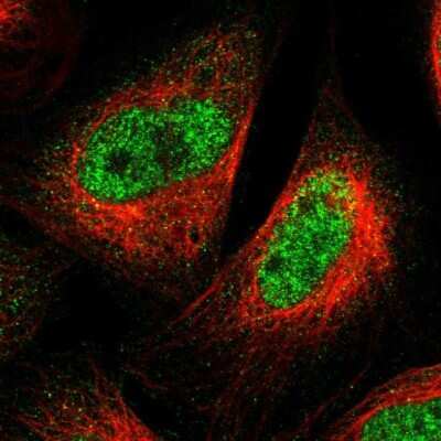 Immunocytochemistry/ Immunofluorescence: SPRTN Antibody [NBP1-84163]