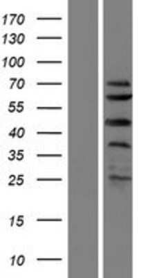 Western Blot: SPRTN Overexpression Lysate [NBP2-06088]