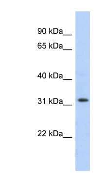 Western Blot: C1orf131 Antibody [NBP1-57829]