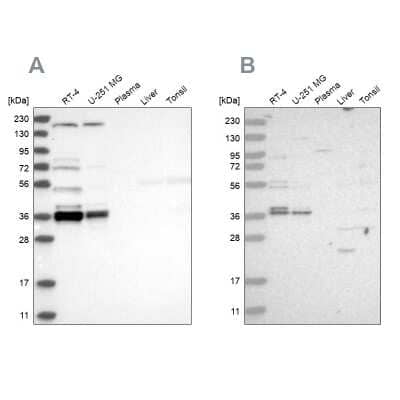 Western Blot: C1orf131 Antibody [NBP1-85097]