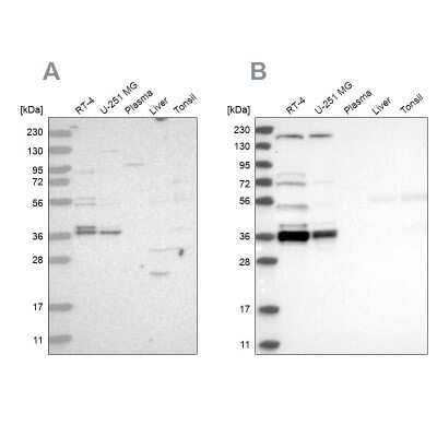 Western Blot: C1orf131 Antibody [NBP1-85098]