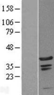 Western Blot: C1orf131 Overexpression Lysate [NBL1-08295]