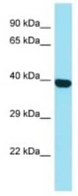 Western Blot: C1orf141 Antibody [NBP3-10760]