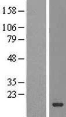 Western Blot: SZRD1 Overexpression Lysate [NBL1-08298]