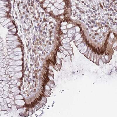 Immunohistochemistry-Paraffin: OBSCN-AS1 Antibody [NBP2-14571]