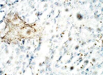 Immunohistochemistry-Paraffin: C1orf146 Antibody [NBP3-12292]