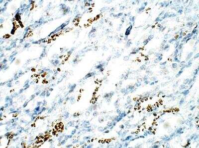 Immunohistochemistry-Paraffin: C1orf146 Antibody [NBP3-12292]