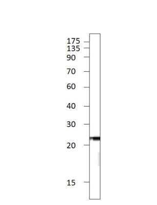 Western Blot: C1orf146 Antibody [NBP3-12292]