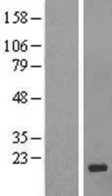 Western Blot: GCSAML Overexpression Lysate [NBL1-08299]