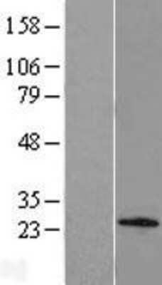 Western Blot: C1orf158 Overexpression Lysate [NBL1-08301]