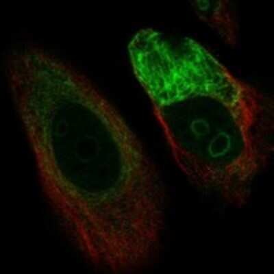 Immunocytochemistry/ Immunofluorescence: C1orf159/RIVIG Antibody [NBP3-17351]