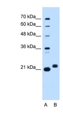 Western Blot: C1orf159/RIVIG Antibody [NBP1-91307]