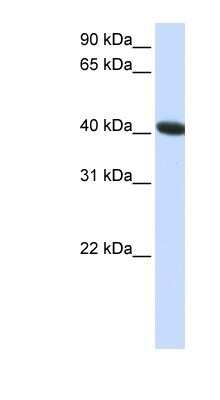 Western Blot: C1orf159/RIVIG Antibody [NBP1-91308]