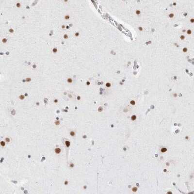 Immunohistochemistry-Paraffin: C1orf162 Antibody [NBP1-93503]
