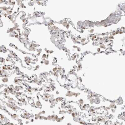 Immunohistochemistry-Paraffin: C1orf162 Antibody [NBP1-93503]