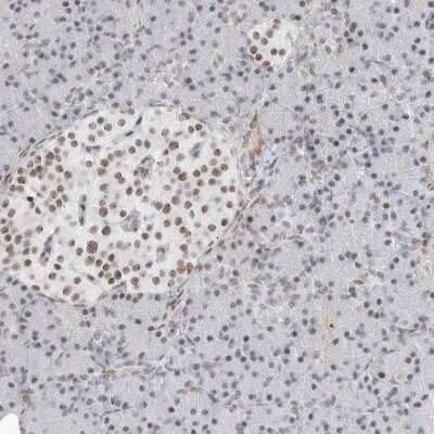 Immunohistochemistry-Paraffin: C1orf162 Antibody [NBP1-93503]