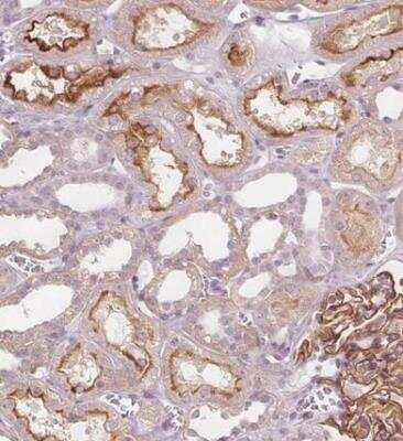 Immunohistochemistry-Paraffin: C1orf167 Antibody [NBP1-90556]