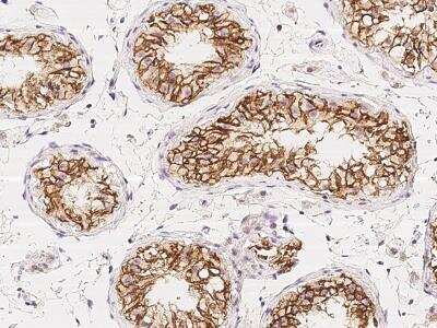 Immunohistochemistry-Paraffin: C1orf167 Antibody [NBP3-06367]