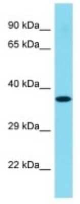 Western Blot: C1orf168 Antibody [NBP3-10744]