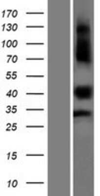 Western Blot: Keratinocyte Differentiation Factor 1 Overexpression Lysate [NBP2-05395]