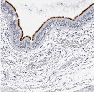 Immunohistochemistry-Paraffin: ERICH3 Antibody [NBP1-94077]