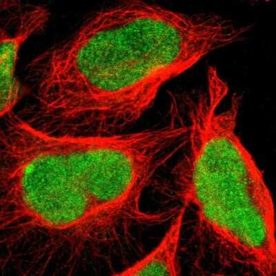 Immunocytochemistry/ Immunofluorescence: C1orf174 Antibody [NBP1-87116]