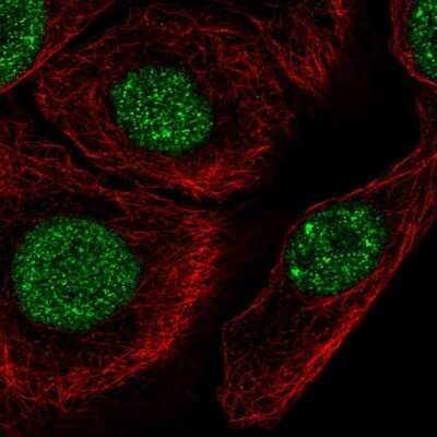 Immunocytochemistry/ Immunofluorescence: C1orf174 Antibody [NBP2-56389]