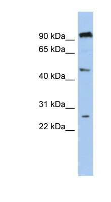 Western Blot: C1orf174 Antibody [NBP1-70453]