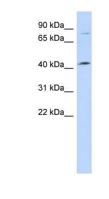 Western Blot: Lymphocyte Expansion Molecule Antibody [NBP1-70454]