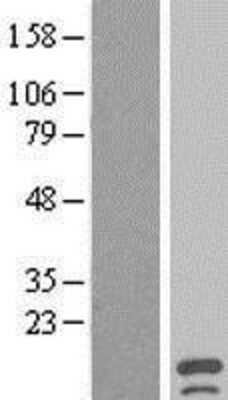 Western Blot: SSTK-IP Overexpression Lysate [NBL1-08305]