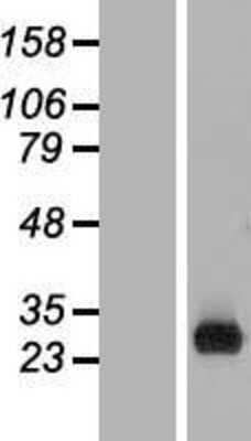 Western Blot: C1orf186 Overexpression Lysate [NBL1-08307]