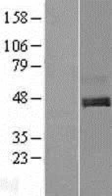 Western Blot: Draxin/C1orf187 Overexpression Lysate [NBL1-08308]