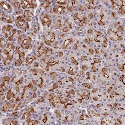 Immunohistochemistry-Paraffin: C1orf189 Antibody [NBP2-14556]