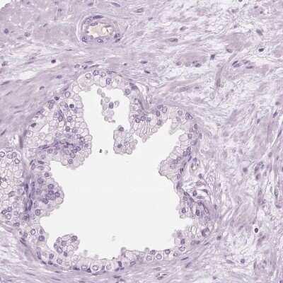 Immunohistochemistry-Paraffin: CFAP126 Antibody [NBP1-94181]