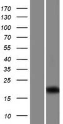 Western Blot: CFAP126 Overexpression Lysate [NBP2-08723]