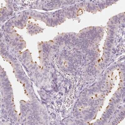 Immunohistochemistry-Paraffin: C1orf194 Antibody [NBP2-38605]