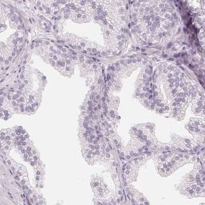 Immunohistochemistry-Paraffin: C1orf194 Antibody [NBP2-38605]