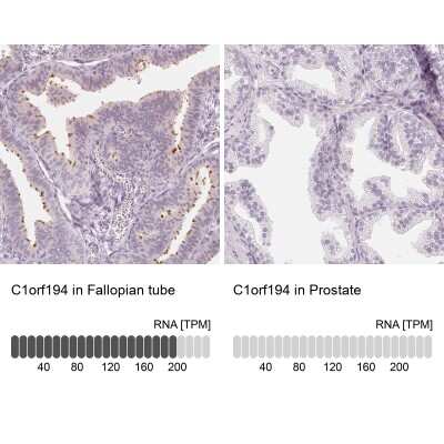Immunohistochemistry-Paraffin: C1orf194 Antibody [NBP2-38605]