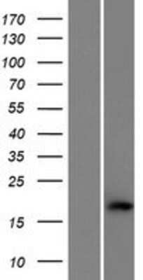 Western Blot: C1orf194 Overexpression Lysate [NBP2-09413]