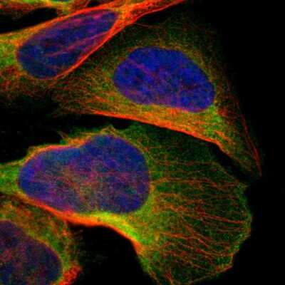 Immunocytochemistry/ Immunofluorescence: C1orf198 Antibody [NBP1-90519]