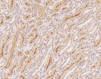 Immunohistochemistry-Paraffin: C1orf198 Antibody [NBP3-12665]